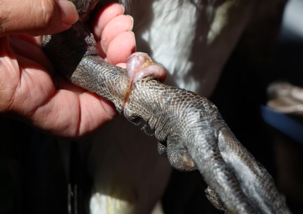 Annette Prince shows the injury a goose incurred after getting tangled in fishing line on Sept. 5, 2024, in Chicago. (Stacey Wescott/Chicago Tribune)