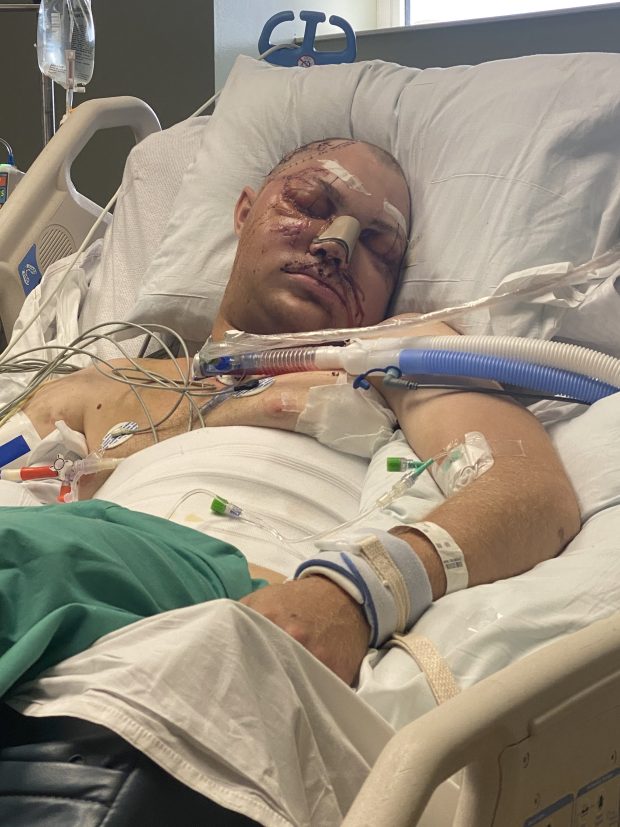 Brad Detert is shown in the hospital while recovering from injuries sustained in a crash on U.S. 30 on Aug. 27, 2020. (Law office of Kenneth J. Allen/provided)