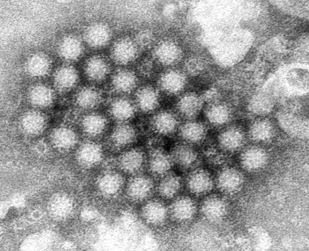 An electron microscope image shows a cluster of norovirus virions. (Charles D. Humphrey/Centers for Disease Control and Prevention)